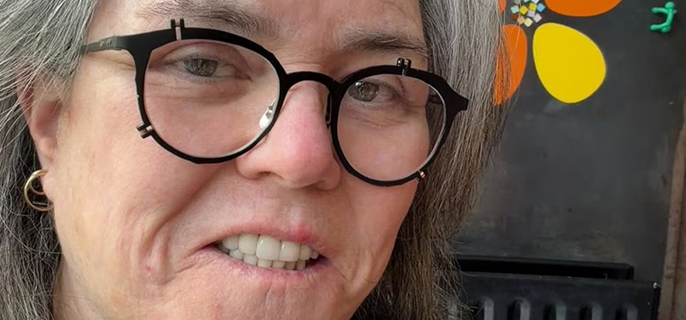 Rosie O'Donnell Says Her New Facelift Cost More Money Than a Car 1