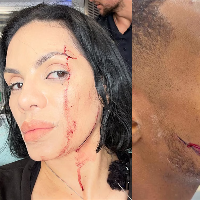 Car Crashes Into Food Influencers NinaUnrated and Patrick Blackwood While They're Eating in Restaurant