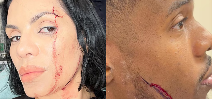 Car Crashes Into Food Influencers NinaUnrated and Patrick Blackwood While They're Eating in Restaurant 1