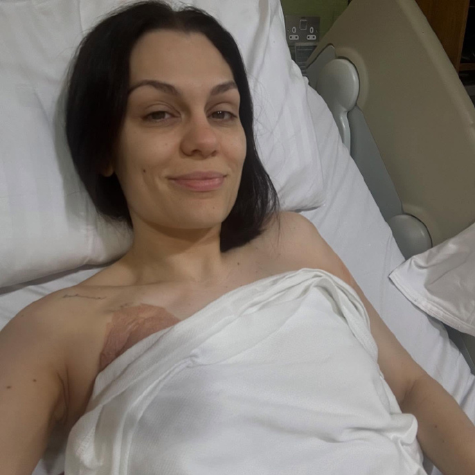 Jessie J Details Recovery After Breast Cancer Surgery