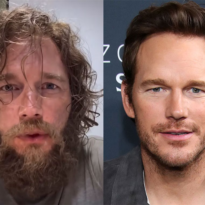 Chris Pratt Is Unrecognizable as He Shares Shocking Transformation
