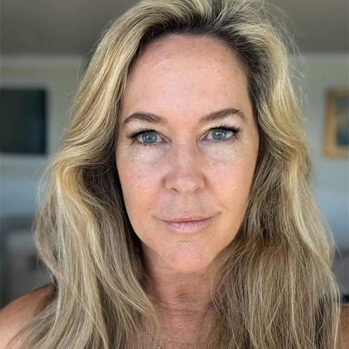 Bewitched's Erin Murphy Claps Back on Facelift Speculation