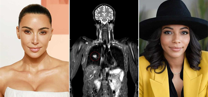 Emmy Producer Discovers She Has Stage 3 Cancer After Kim Kardashian Posts About Body Scan: 'I Would Have Died' 1