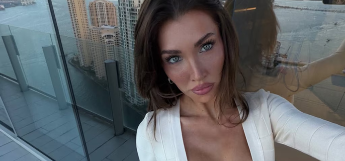 Kate Cassidy Says She Was Stopped by TSA After Cosmetic Procedures Altered Her Appearance 1