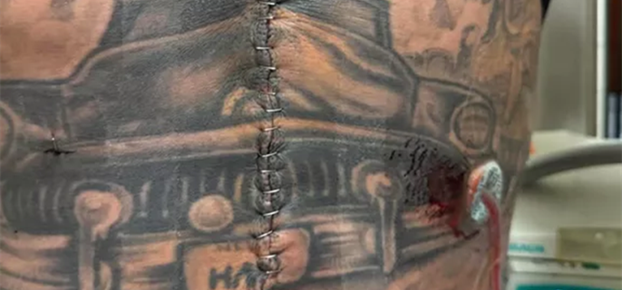 Carey Hart Apologizes to Wife Pink in Post Revealing Brutal Injury: 'Severed My Small Intestine from My Colon' 1