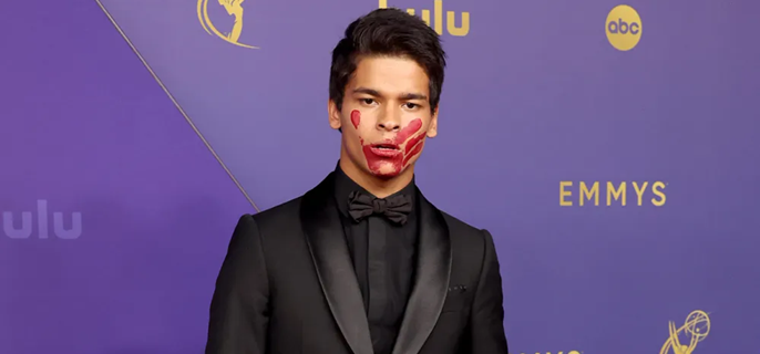 ‘Reservation Dogs’ Star D’Pharaoh Woon-A-Tai Brings Symbolic Message to Emmys With Red Hand Painted on Face 1