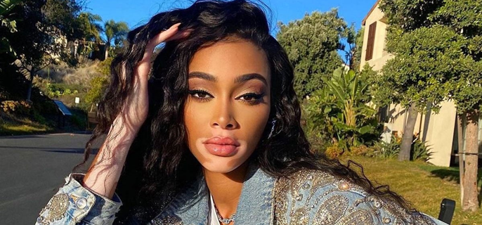 Winnie Harlow takes new educational initiative to normalise vitiligo 1