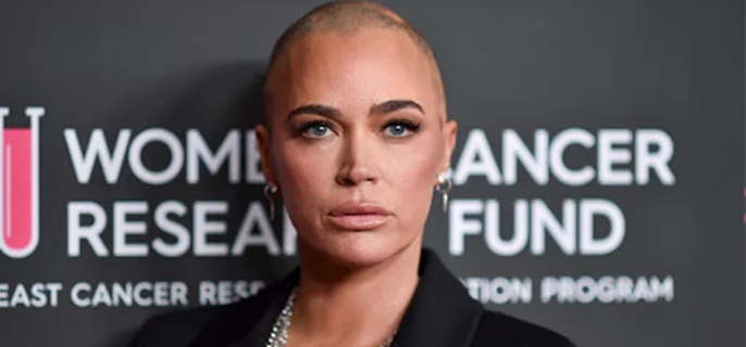 Teddi Mellencamp views cancer as ‘payback’ 1