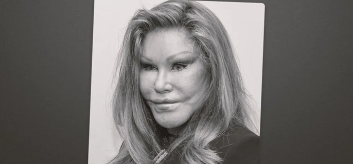 Jocelyn Wildenstein, “Catwoman” New York Tabloid Fixture, Dies at 79 1