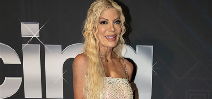 Tori Spelling Admits Her Dog Once Nibbled on a “Severed Human Big Toe” 1
