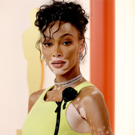 Winnie Harlow Shuts Down Childhood Bullies in a Powerful Cruella de Vil Costume