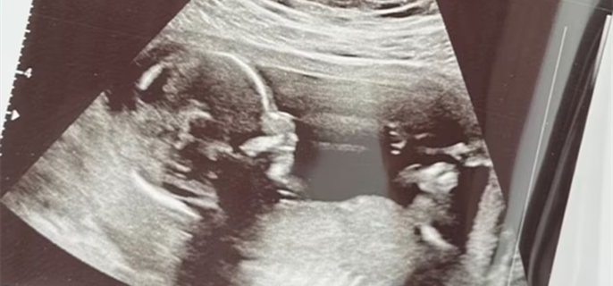 Bachelorette’s Emily Maynard Is Going to Be a Grandma, Daughter Ricki Expecting Baby 1