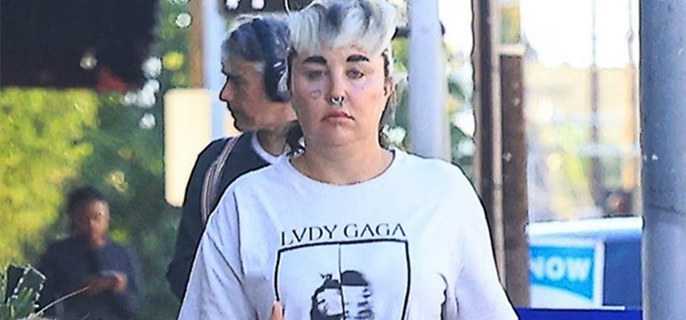 Amanda Bynes Shares She's Lost 28 Pounds After Using Ozempic 1