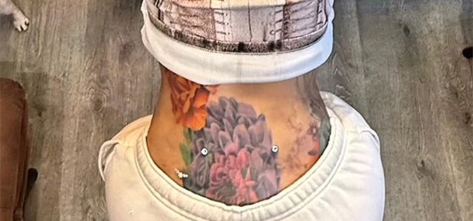 Cardi B Reveals 4 New Dermal Implants on Her Neck and Lower Back 1