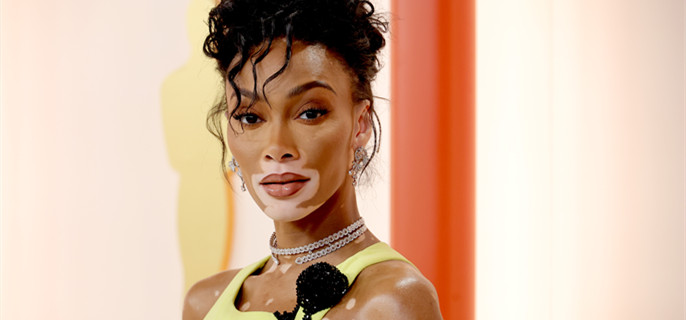 Winnie Harlow Shuts Down Childhood Bullies in a Powerful Cruella de Vil Costume 1