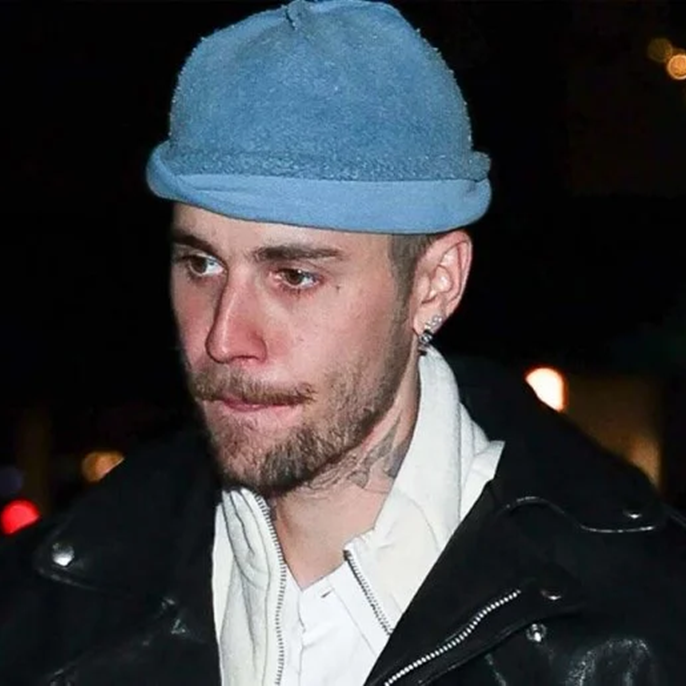 Everything to know about Justin Bieber's facial paralysis